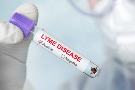 test tube being held by a lab worker that says "lyme disease" on it
