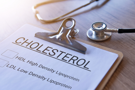 clipboard that reads" cholesterol" with boxes next to HDL and LDL